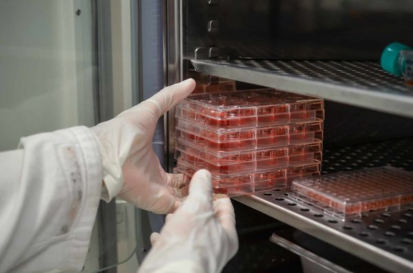 How to Foster Innovation and Creativity in Your Work and Personal Projects?